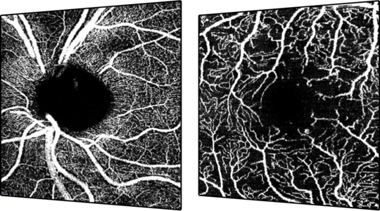 OCT Angiography Module
